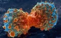 agenda.Toulouse-annuaire - Organisme Et Cancer