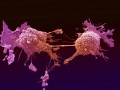 agenda.Toulouse-annuaire - Cancer